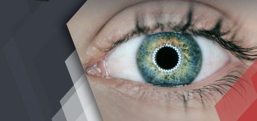 Artificial Retina