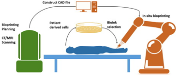 In-situ Bioprinting